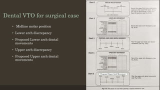 Dental VTO for surgical case
• Midline molar position
• Lower arch discrepancy
• Proposed Lower arch dental
movements
• Upper arch discrepancy
• Proposed Upper arch dental
movements
Proposed Upper Arch Movement
 