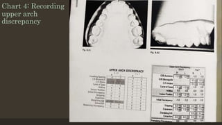 Chart 4: Recording
upper arch
discrepancy
12/19/2020 59
 