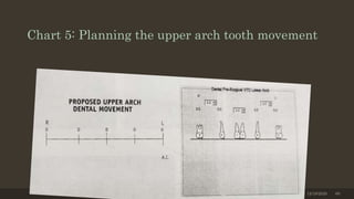 Chart 5: Planning the upper arch tooth movement
12/19/2020 60
 