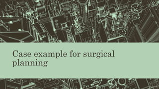 Case example for surgical
planning
12/19/202080
 