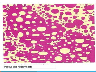 Positive and negative dots
 