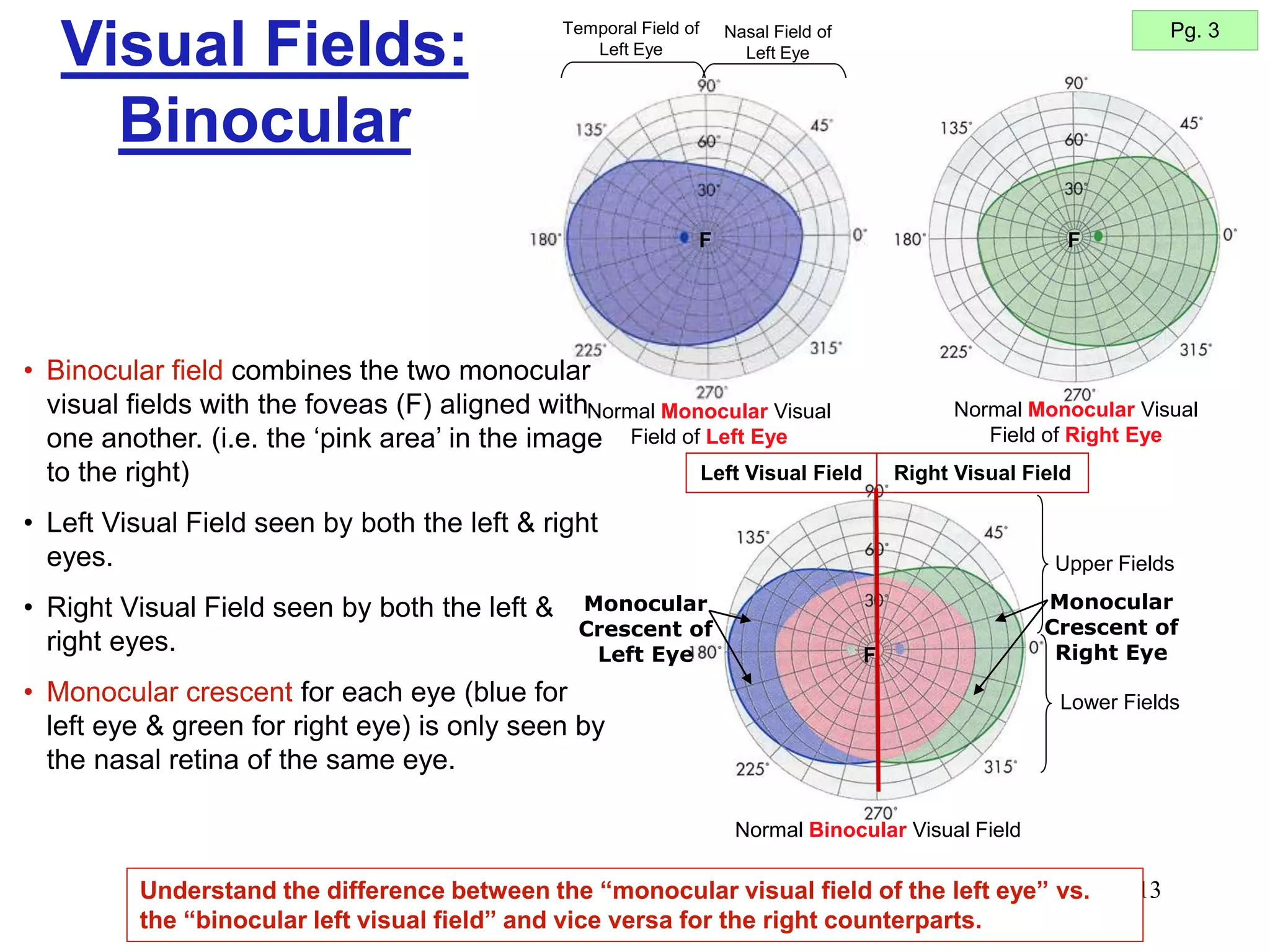 13
Visual Fields:
Binocular
Pg. 3
Normal Binocular Visual Field
F
Right Visual Field
Left Visual Field
Upper Fields
Lower Fields
Temporal Field of
Left Eye
Nasal Field of
Left Eye
Normal Monocular Visual
Field of Left Eye
F F
Normal Monocular Visual
Field of Right Eye
Understand the difference between the “monocular visual field of the left eye” vs.
the “binocular left visual field” and vice versa for the right counterparts.
• Binocular field combines the two monocular
visual fields with the foveas (F) aligned with
one another. (i.e. the ‘pink area’ in the image
to the right)
• Left Visual Field seen by both the left & right
eyes.
• Right Visual Field seen by both the left &
right eyes.
• Monocular crescent for each eye (blue for
left eye & green for right eye) is only seen by
the nasal retina of the same eye.
Monocular
Crescent of
Right Eye
Monocular
Crescent of
Left Eye
 