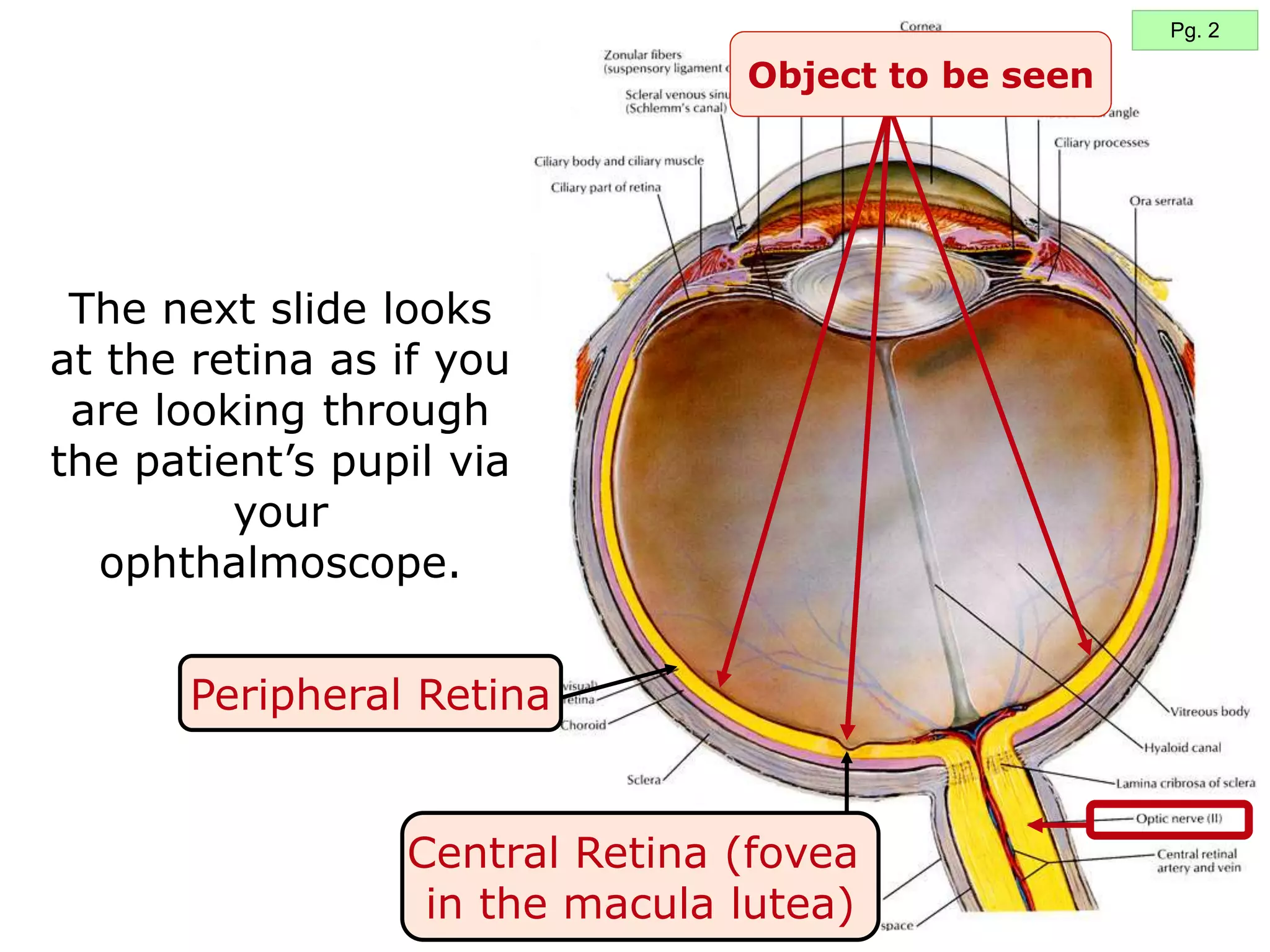 8
Object to be seen
Peripheral Retina
The next slide looks
at the retina as if you
are looking through
the patient’s pupil via
your
ophthalmoscope.
Central Retina (fovea
in the macula lutea)
Pg. 2
 