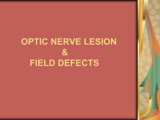 OPTIC NERVE LESION
        &
 FIELD DEFECTS
 