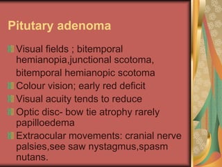 Pitutary adenoma
 Visual fields ; bitemporal
 hemianopia,junctional scotoma,
 bitemporal hemianopic scotoma
 Colour vision; early red deficit
 Visual acuity tends to reduce
 Optic disc- bow tie atrophy rarely
 papilloedema
 Extraocular movements: cranial nerve
 palsies,see saw nystagmus,spasm
 nutans.
 