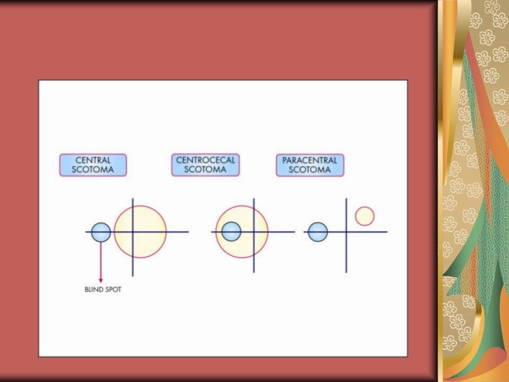 Visual pathway