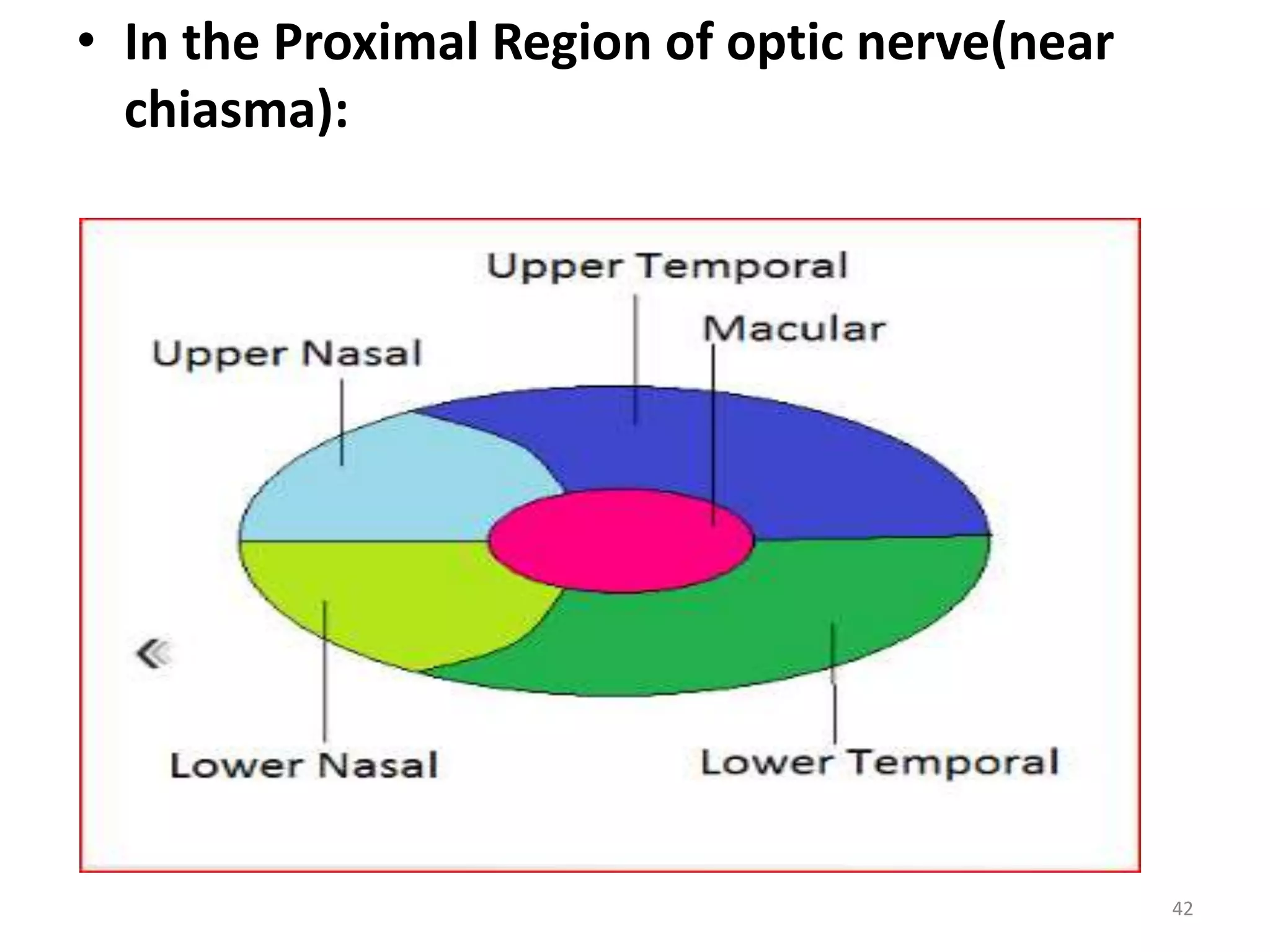 • In the Proximal Region of optic nerve(near
chiasma):
42
 