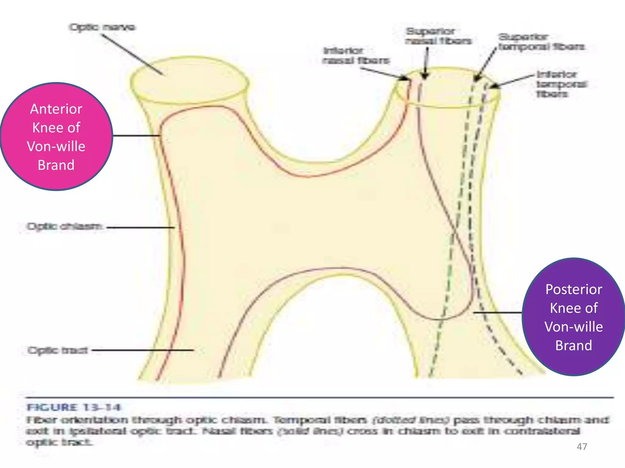 47
Anterior
Knee of
Von-wille
Brand
Posterior
Knee of
Von-wille
Brand
 