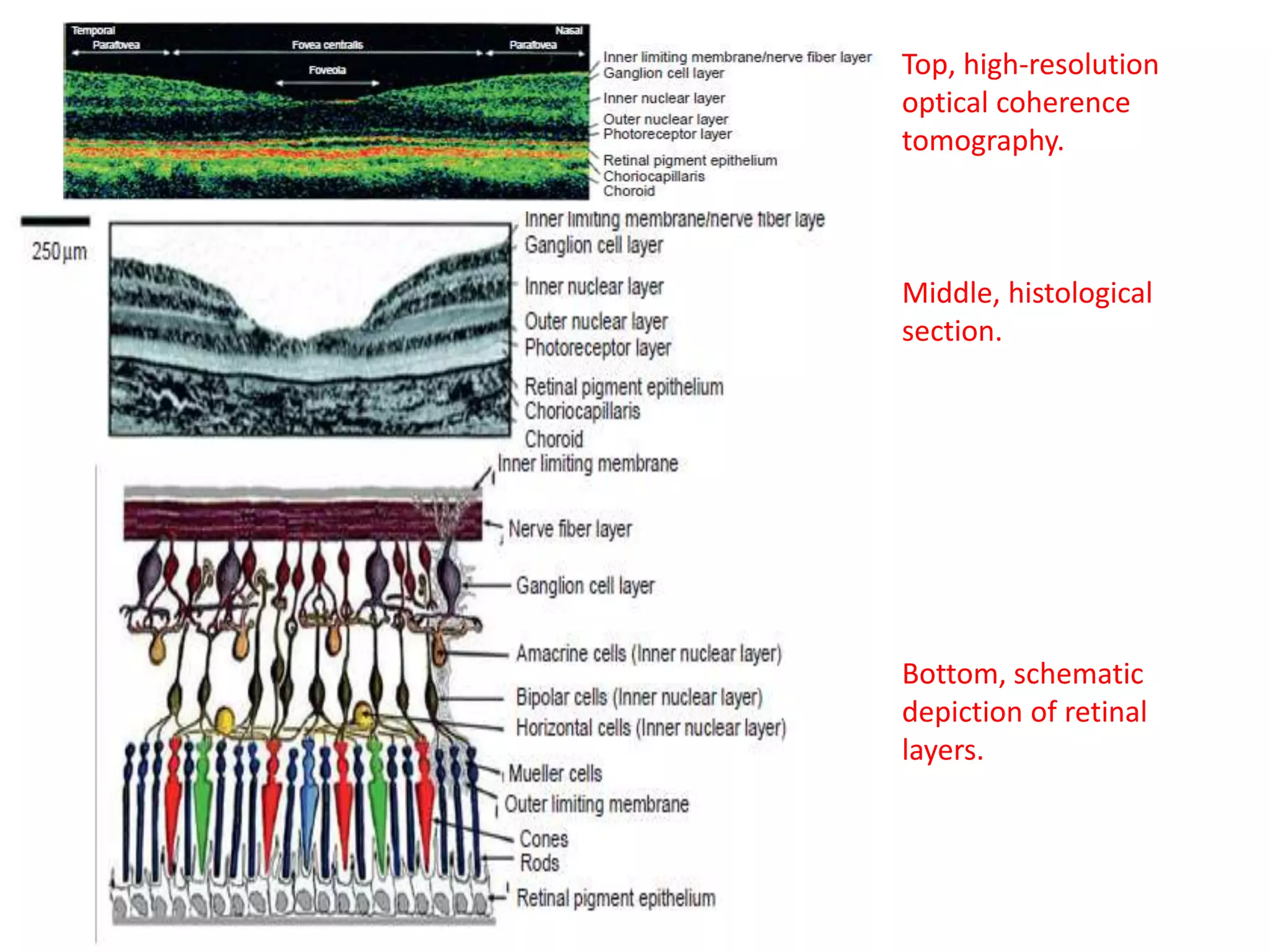 Top, high-resolution
optical coherence
tomography.
Middle, histological
section.
Bottom, schematic
depiction of retinal
layers.
 