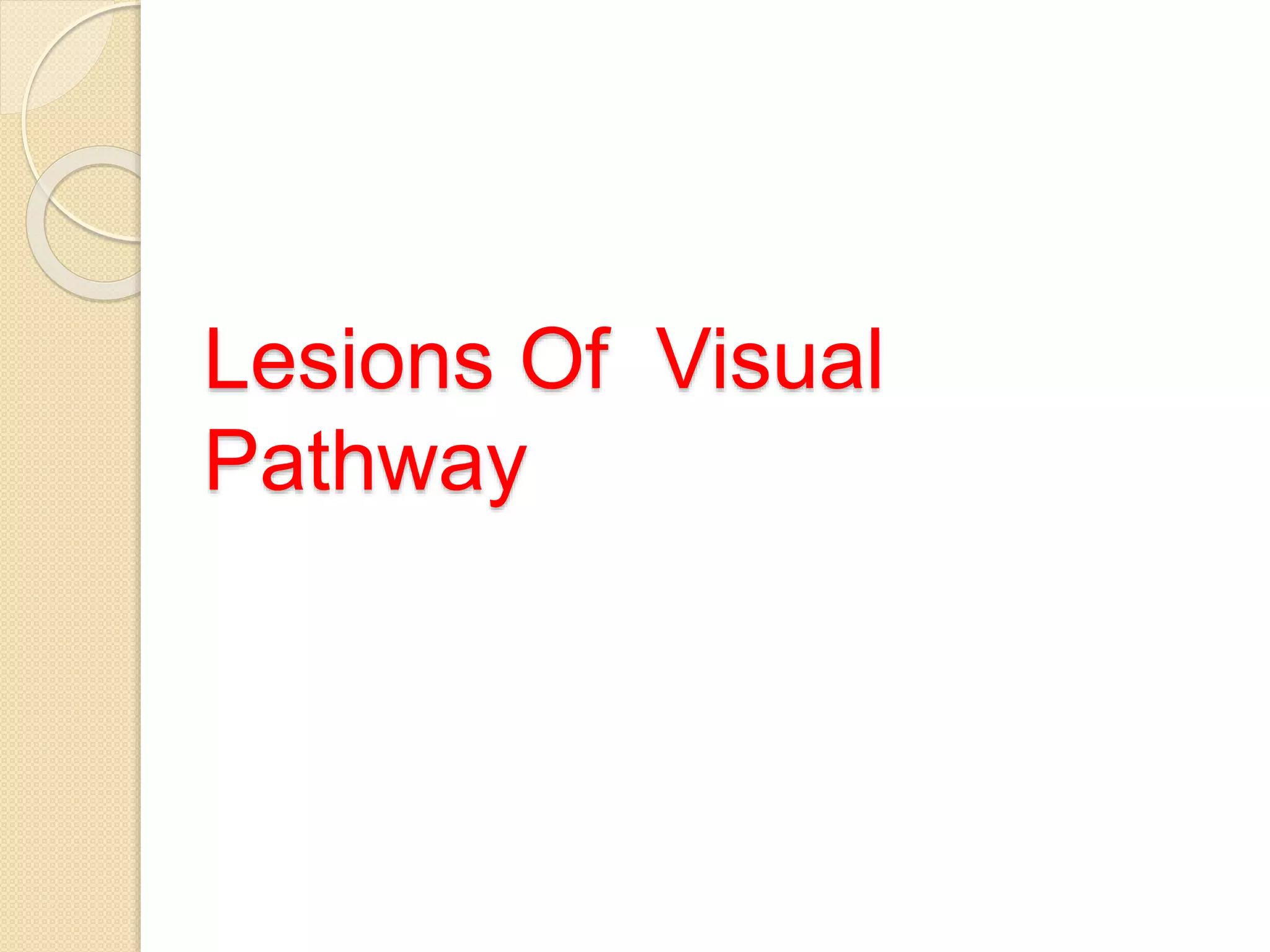 Lesions Of Visual
Pathway
 