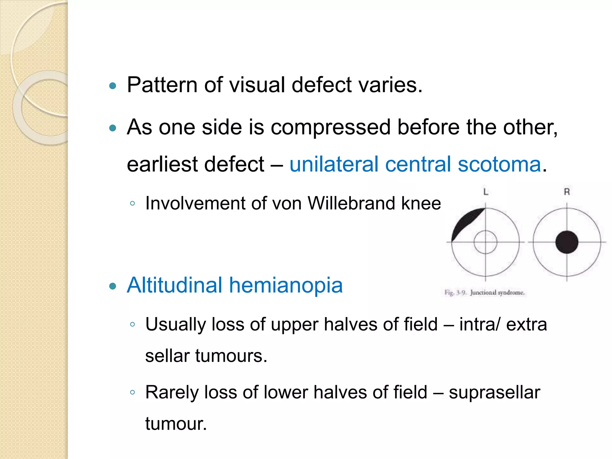  Pattern of visual defect varies.
 As one side is compressed before the other,
earliest defect – unilateral central scotoma.
◦ Involvement of von Willebrand knee.
 Altitudinal hemianopia
◦ Usually loss of upper halves of field – intra/ extra
sellar tumours.
◦ Rarely loss of lower halves of field – suprasellar
tumour.
 