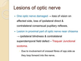 Lesions of optic nerve
 One optic nerve damaged → loss of vision on
affected side, loss of ipsilateral direct &
contralateral consensual pupillary reflexes.
 Lesion in proximal part of optic nerve near chiasma
→ ipsilateral blindness & contralateral
superotemporal field defect – Traquair Junctional
scotoma.
 Due to involvement of crossed fibres of opp side as
they loop forward into the nerve.
 