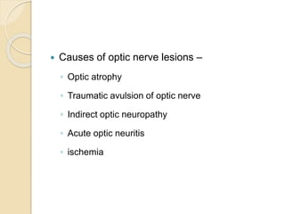  Causes of optic nerve lesions –
◦ Optic atrophy
◦ Traumatic avulsion of optic nerve
◦ Indirect optic neuropathy
◦ Acute optic neuritis
◦ ischemia
 