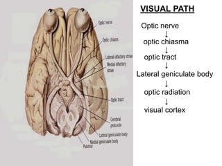 VISUAL PATH
Optic nerve
↓
optic chiasma
↓
optic tract
↓
Lateral geniculate body
↓
optic radiation
↓
visual cortex
 