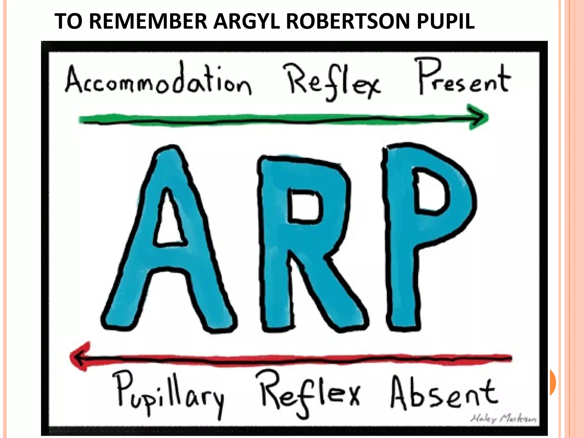 TO REMEMBER ARGYL ROBERTSON PUPIL
 