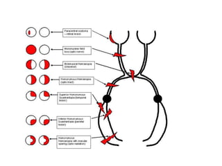 Visual pathway ,visual cortex and hemianopias | PPTX