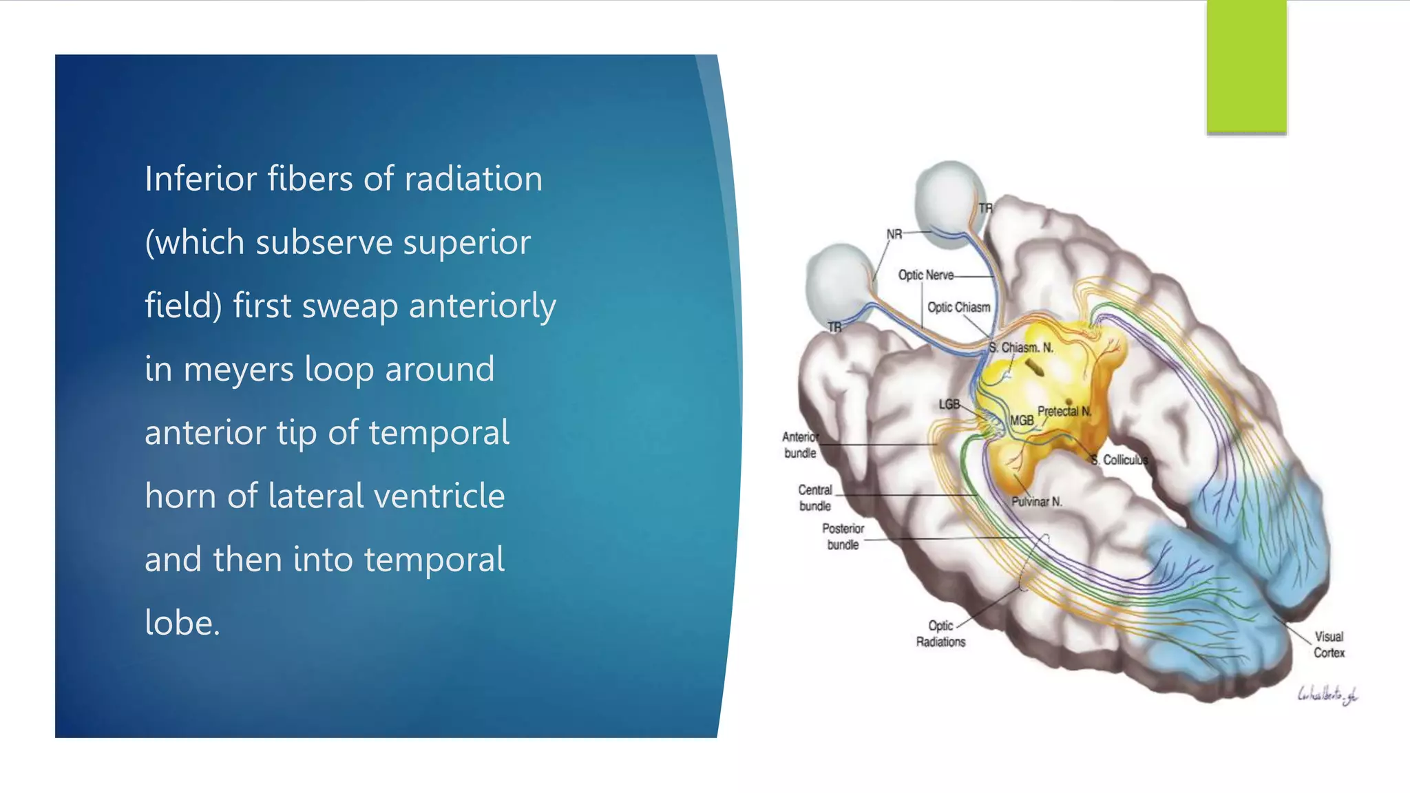 Inferior fibers of radiation
(which subserve superior
field) first sweap anteriorly
in meyers loop around
anterior tip of temporal
horn of lateral ventricle
and then into temporal
lobe.
 