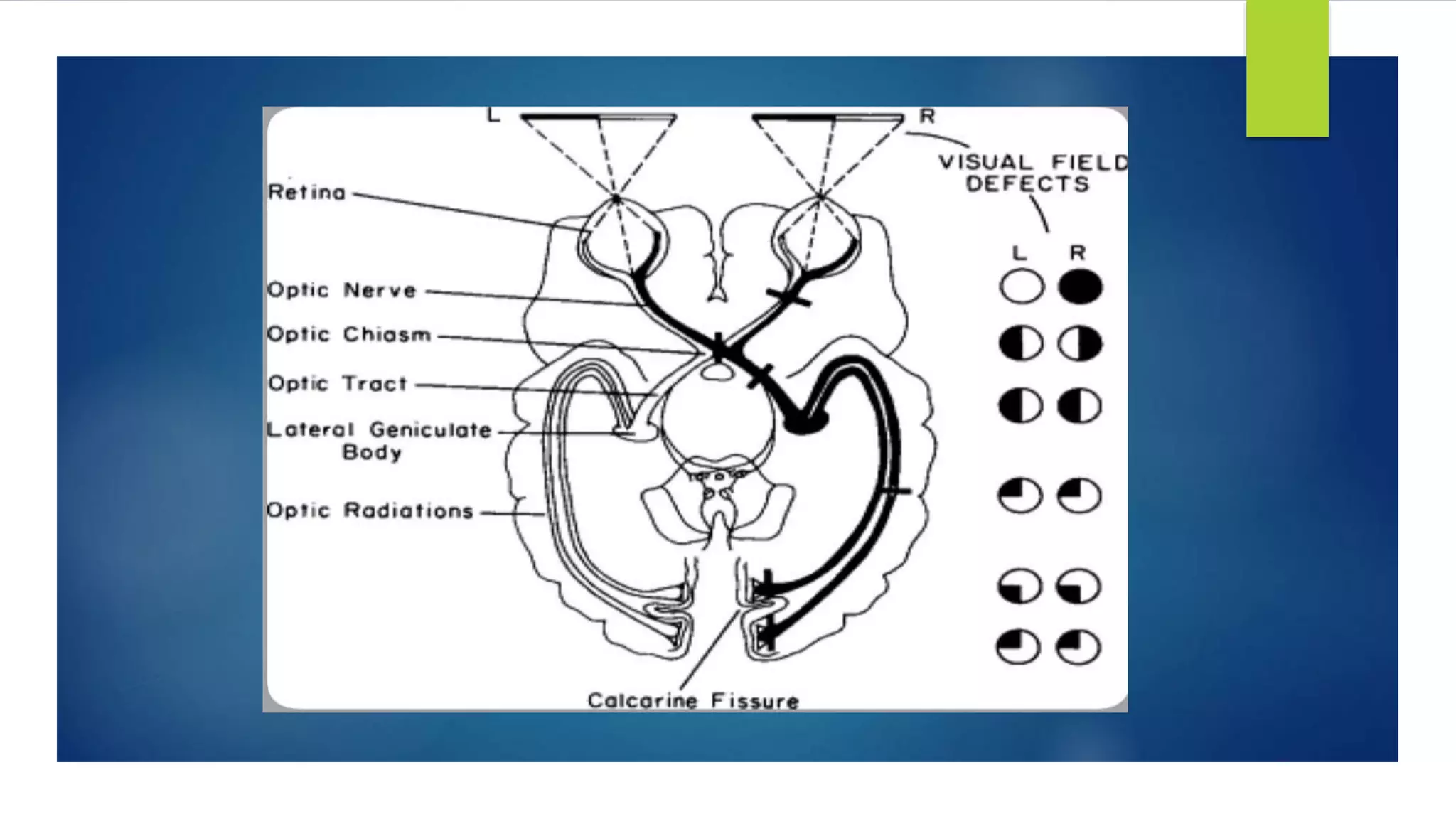 visual pathway.pptx