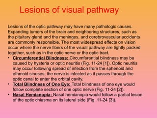 Visual pathway of the human eye anatomyy | PPTX