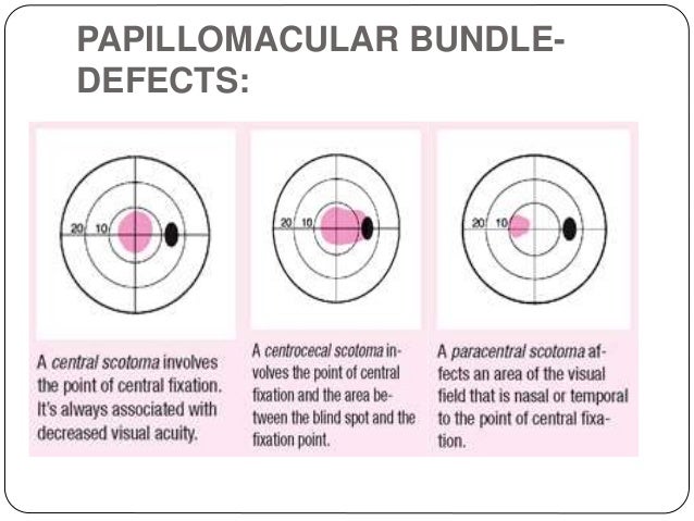 Visual pathway and its defects