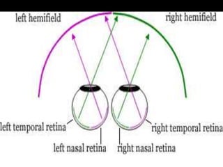 Visual pathway and its defects | PPTX