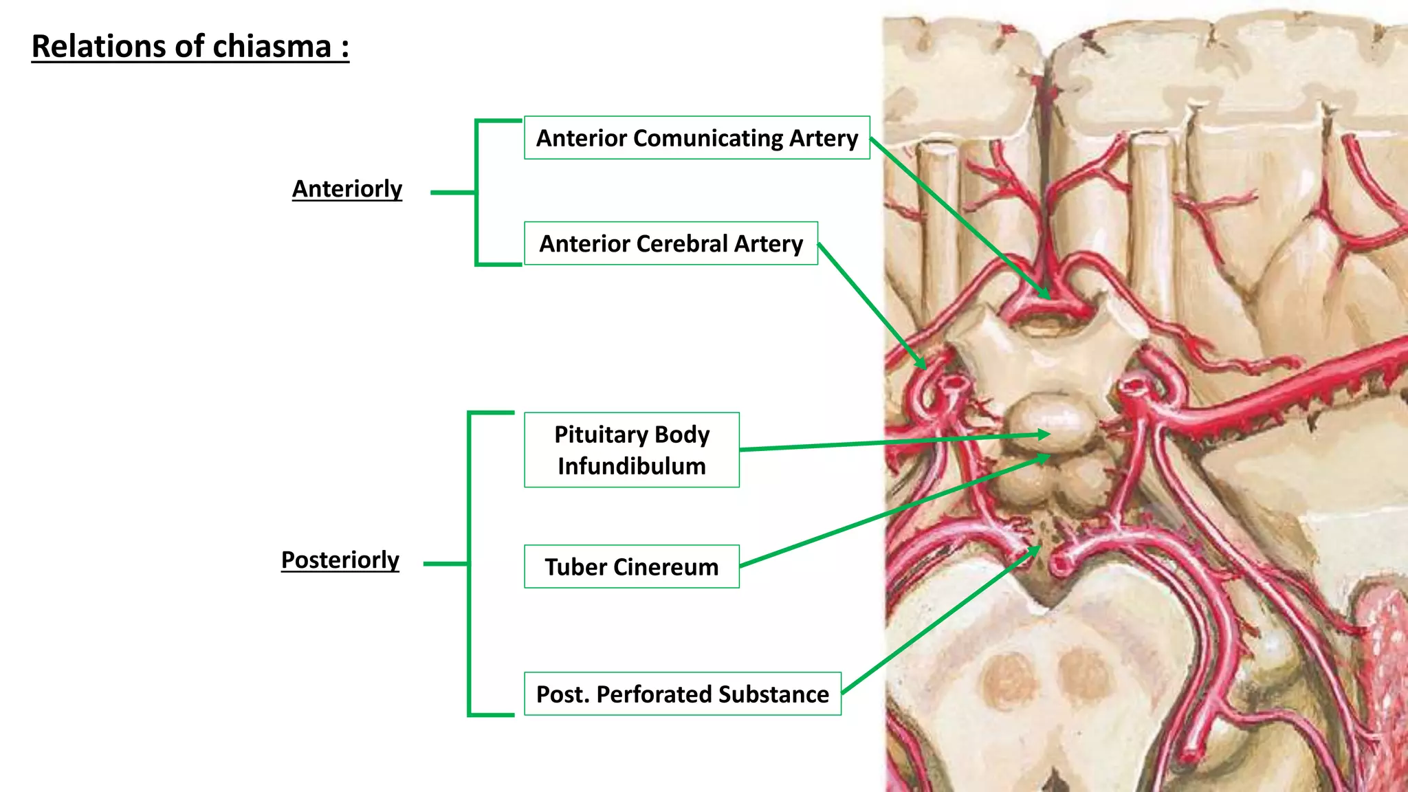 Relations of chiasma :
Anterior Comunicating Artery
Anterior Cerebral Artery
Post. Perforated Substance
Pituitary Body
Infundibulum
Tuber Cinereum
Anteriorly
Posteriorly
 