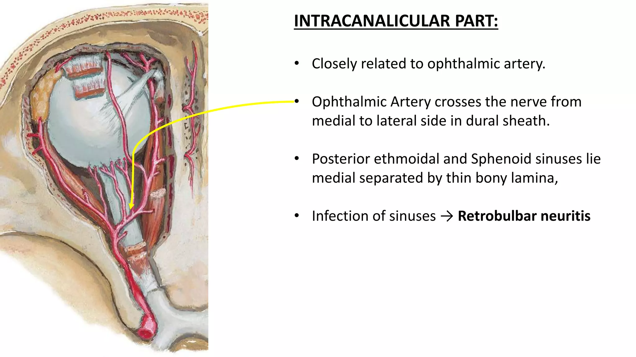 INTRACANALICULAR PART:
• Closely related to ophthalmic artery.
• Ophthalmic Artery crosses the nerve from
medial to lateral side in dural sheath.
• Posterior ethmoidal and Sphenoid sinuses lie
medial separated by thin bony lamina,
• Infection of sinuses → Retrobulbar neuritis
 