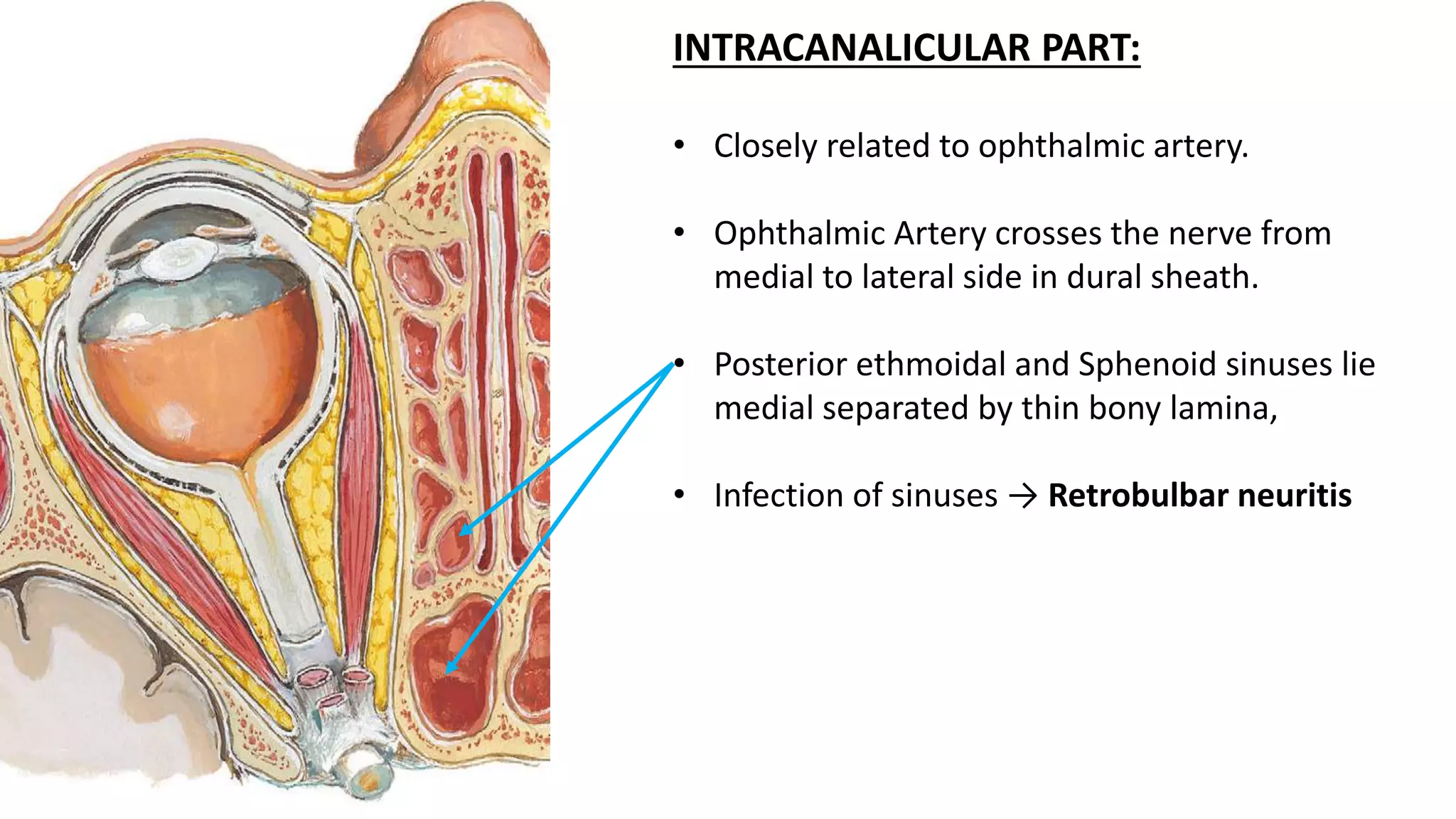 INTRACANALICULAR PART:
• Closely related to ophthalmic artery.
• Ophthalmic Artery crosses the nerve from
medial to lateral side in dural sheath.
• Posterior ethmoidal and Sphenoid sinuses lie
medial separated by thin bony lamina,
• Infection of sinuses → Retrobulbar neuritis
 