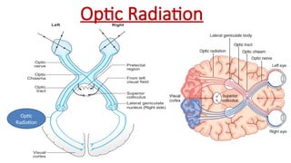 Optic Radiation
Optic
Radiation
 