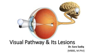 Visual Pathway & Its Lesions
Dr. Sara Sadiq
(MBBS, M.Phil)
 
