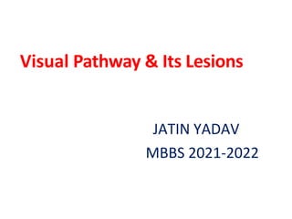 Visual Pathway & Its Lesions
JATIN YADAV
MBBS 2021-2022
 