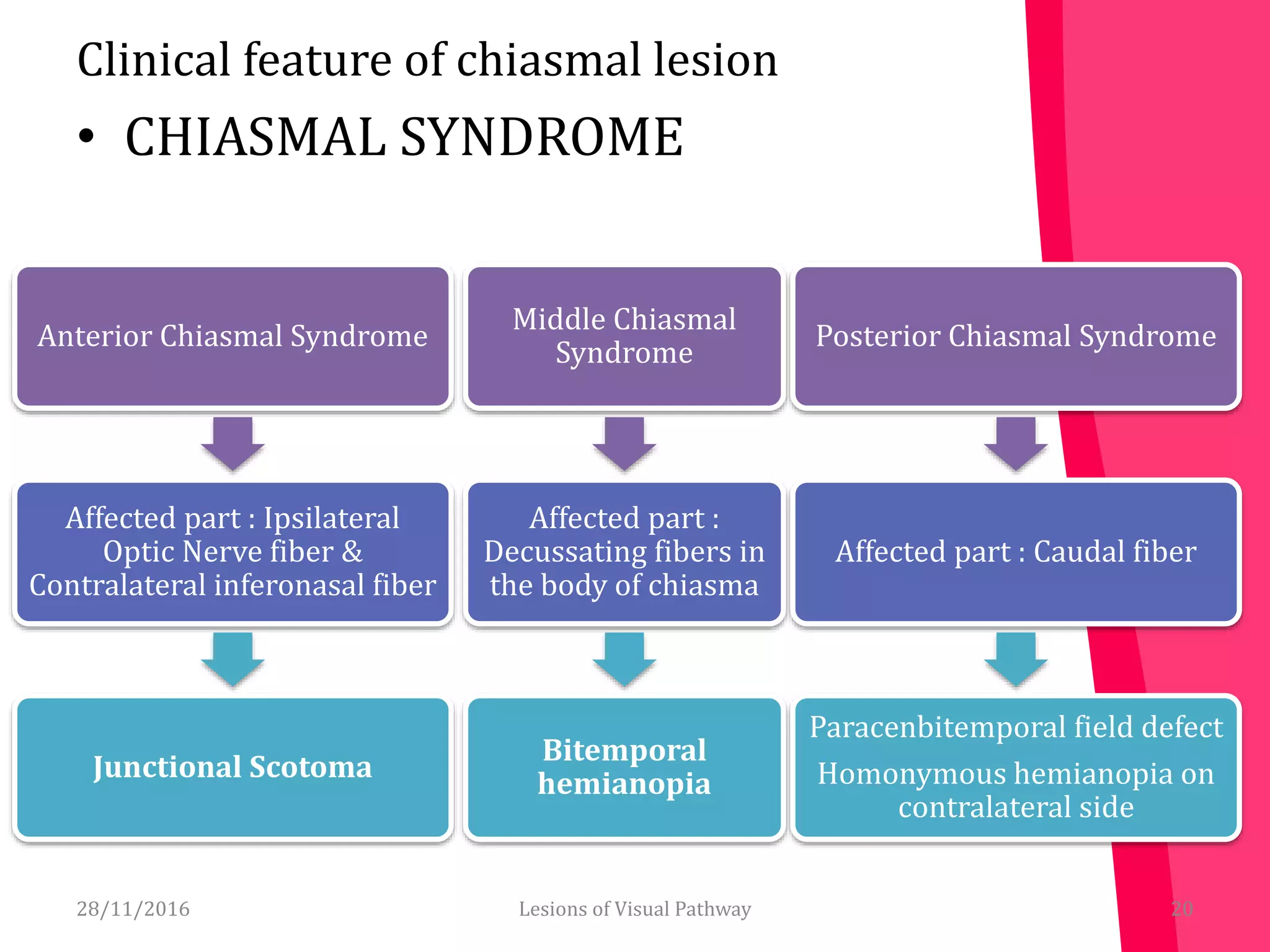 Clinical feature of chiasmal lesion
• CHIASMAL SYNDROME
28/11/2016 20
Anterior Chiasmal Syndrome
Affected part : Ipsilateral
Optic Nerve fiber &
Contralateral inferonasal fiber
Junctional Scotoma
Middle Chiasmal
Syndrome
Affected part :
Decussating fibers in
the body of chiasma
Bitemporal
hemianopia
Posterior Chiasmal Syndrome
Affected part : Caudal fiber
Paracenbitemporal field defect
Homonymous hemianopia on
contralateral side
Lesions of Visual Pathway
 