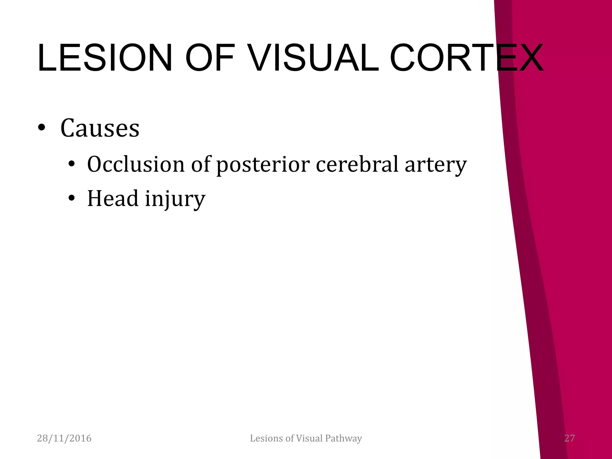 LESION OF VISUAL CORTEX
• Causes
• Occlusion of posterior cerebral artery
• Head injury
28/11/2016 27Lesions of Visual Pathway
 