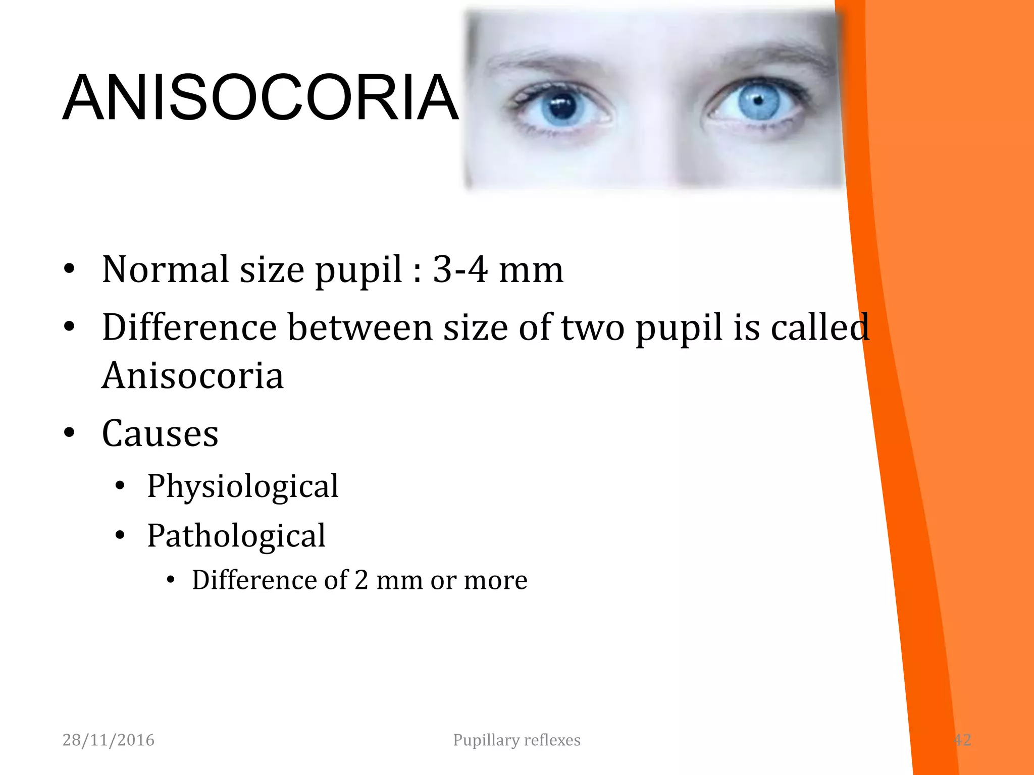 ANISOCORIA
• Normal size pupil : 3-4 mm
• Difference between size of two pupil is called
Anisocoria
• Causes
• Physiological
• Pathological
• Difference of 2 mm or more
28/11/2016 Pupillary reflexes 42
 