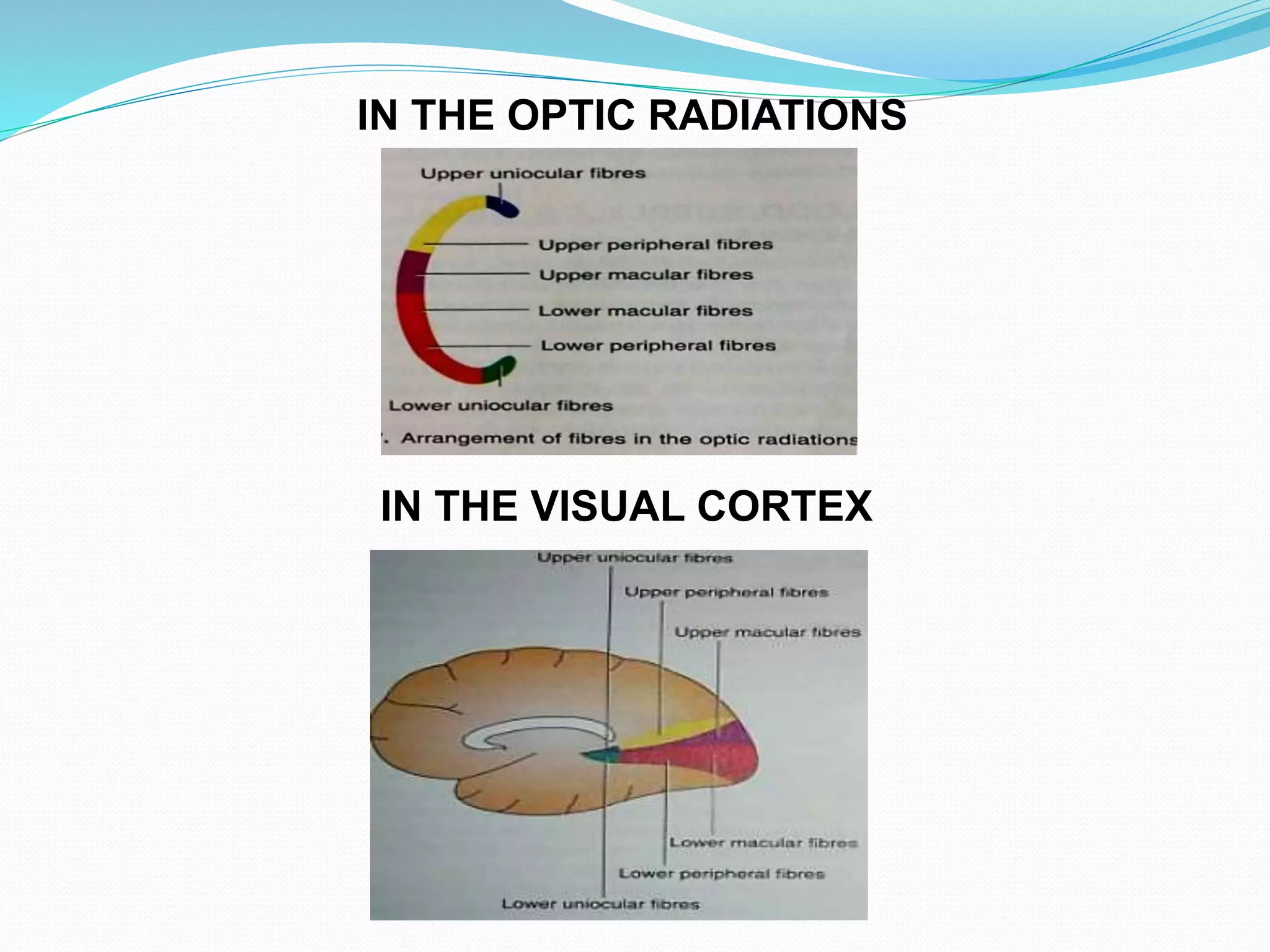 IN THE OPTIC RADIATIONS
IN THE VISUAL CORTEX
 