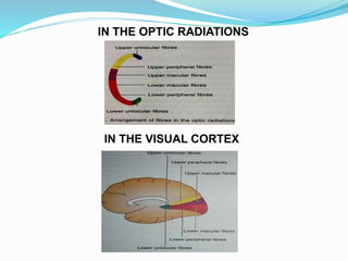 Visual pathway ppt | PPTX