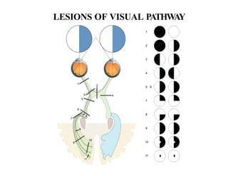 visual pathway ppt of light uploaded.pptx