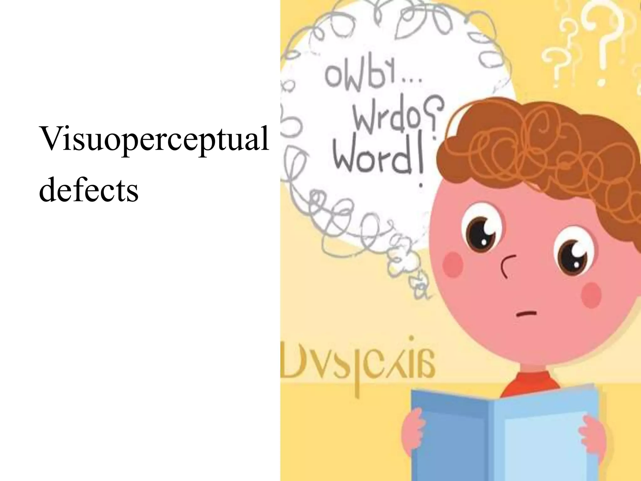 Visuoperceptual
defects
 