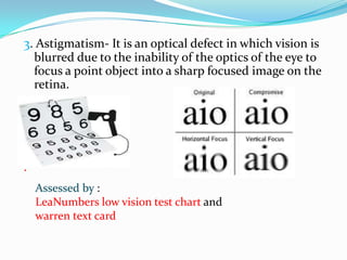 3. Astigmatism- It is an optical defect in which vision is
blurred due to the inability of the optics of the eye to
focus a point object into a sharp focused image on the
retina.

.
Assessed by :
LeaNumbers low vision test chart and
warren text card

 