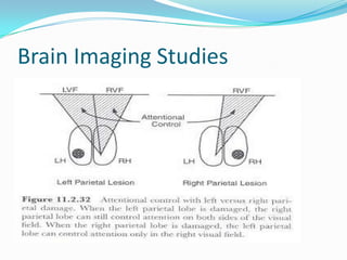 Brain Imaging Studies

 