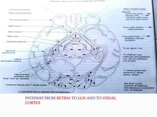 PATHWAY FROM RETINA TO LGN AND TO VISUAL
CORTEX

 