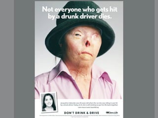 picture of ad with disﬁgured
woman who wasn’t killed by a
drunk driver
 