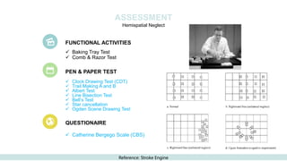 ✓ Baking Tray Test
✓ Comb & Razor Test
✓ Clock Drawing Test (CDT)
✓ Trail Making A and B
✓ Albert Test
✓ Line Bisection Test
✓ Bell’s Test
✓ Star cancellation
✓ Ogden Scene Drawing Test
✓ Catherine Bergego Scale (CBS)
QUESTIONAIRE
PEN & PAPER TEST
FUNCTIONAL ACTIVITIES
Hemispatial Neglect
ASSESSMENT
Reference: Stroke Engine
 