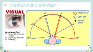 VISUAL
Normal visual field
90’ Temporally to central
fixation
50’ Superiorly & Nasally
60’ Inferiorly
INTERVENTION’S STRATEGY
 