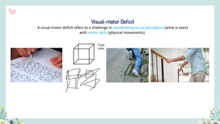 Visual-motor Deficit
A visual motor deficit refers to a challenge in coordinating visual perception (what is seen)
with motor skills (physical movements).
 