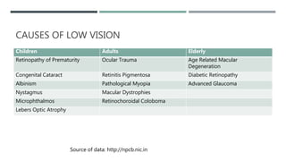 CAUSES OF LOW VISION
Children Adults Elderly
Retinopathy of Prematurity Ocular Trauma Age Related Macular
Degeneration
Congenital Cataract Retinitis Pigmentosa Diabetic Retinopathy
Albinism Pathological Myopia Advanced Glaucoma
Nystagmus Macular Dystrophies
Microphthalmos Retinochoroidal Coloboma
Lebers Optic Atrophy
Source of data: http://npcb.nic.in
 