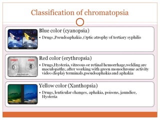 Visual Symptomology from Optometrist Point of View | PPT | Eye and ...