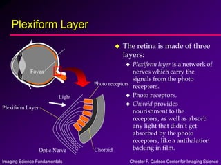Imaging Science Fundamentals Chester F. Carlson Center for Imaging Science
Plexiform Layer
 The retina is made of three
layers:
 Plexiform layer is a network of
nerves which carry the
signals from the photo
receptors.
 Photo receptors.
 Choroid provides
nourishment to the
receptors, as well as absorb
any light that didn’t get
absorbed by the photo
receptors, like a antihalation
backing in film.
Fovea
Plexiform Layer
Photo receptors
Choroid
Optic Nerve
Light
 
