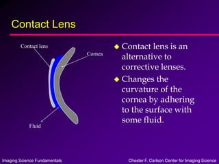 Imaging Science Fundamentals Chester F. Carlson Center for Imaging Science
Contact Lens
 Contact lens is an
alternative to
corrective lenses.
 Changes the
curvature of the
cornea by adhering
to the surface with
some fluid.
Cornea
Contact lens
Fluid
 