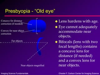 Imaging Science Fundamentals Chester F. Carlson Center for Imaging Science
Presbyopia - “Old eye”
 Lens hardens with age.
 Eye cannot adequately
accommodate near
objects.
 Bifocals (lens with two
focal lengths) contains
a concave lens for
distance (if needed)
and a convex lens for
near objects.
Near objects magnified
Far objects
Concave for distance
correction (if needed)
Convex for near object
correction
 